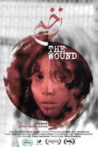 The Wound